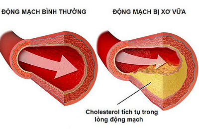 nhung nguyen nhan gay thieu mau nao pho bien hien 2